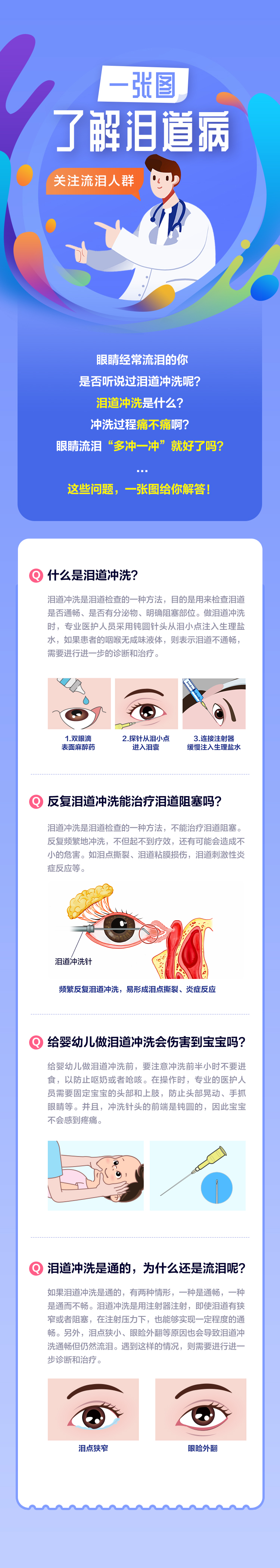 【泪道病】一张图了解泪道冲洗